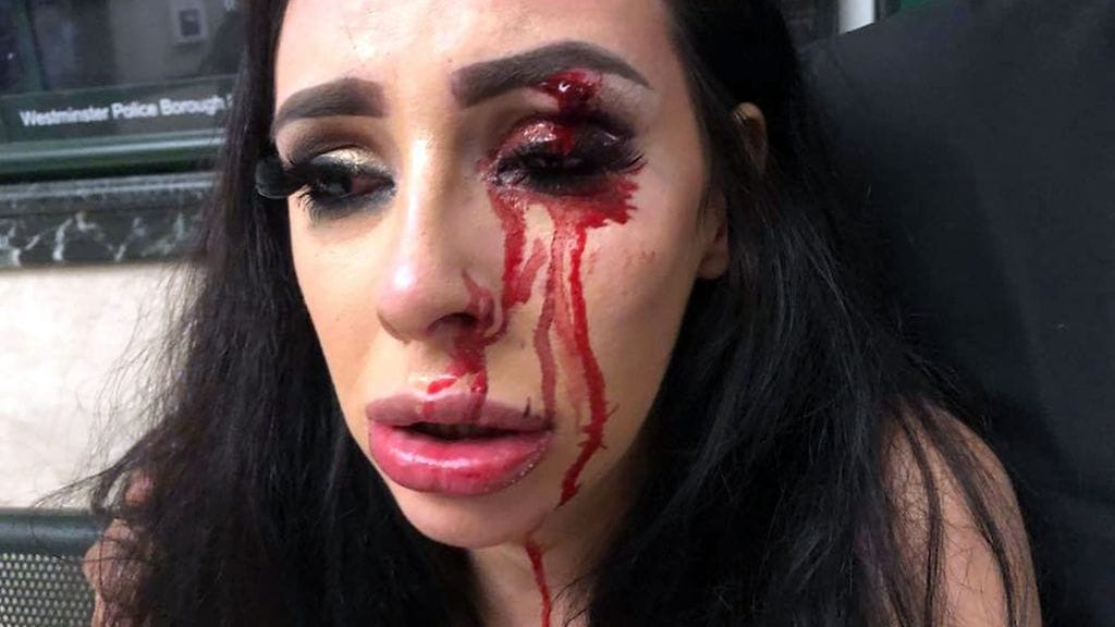 elle stevenson pahoinpitely2