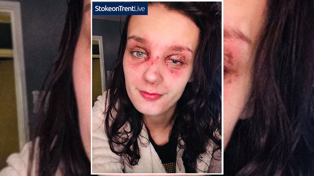 Kuvakaappaus Stoke Sentinel