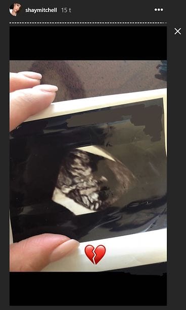 shay mitchell keskenmeno