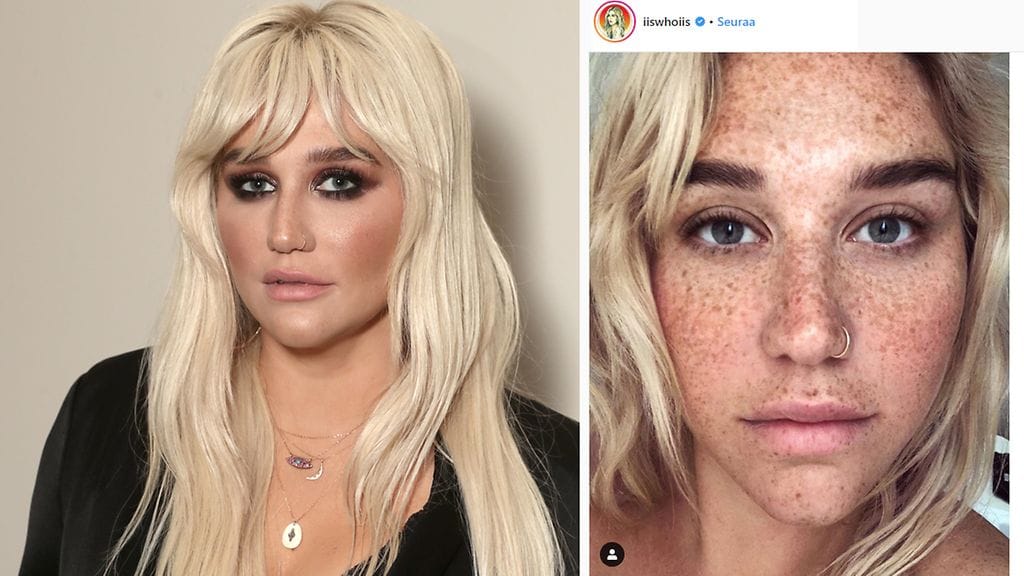 Laulaja Kesha julistaa Instagramissa rakastavansa itseään juuri sellaisena kuin on.