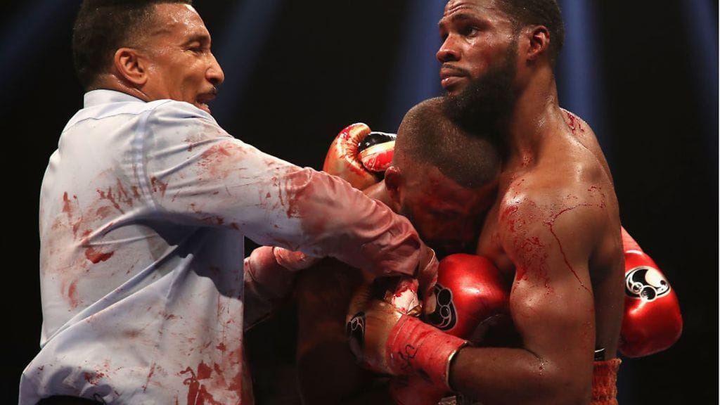 Badou Jackin otsa aukesi niin pahasti, että kehätuomari Tony Weeksin paita värjäytyi punaiseksi.