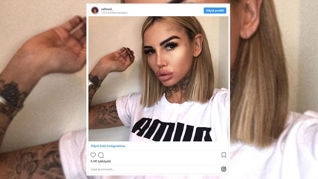 Tosi-tv-tähti haluaa kantapäihinsä implantit.