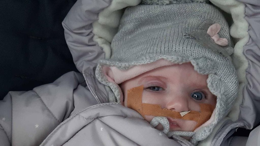 Katin Inna-tytär sairastaa harvinaista Goldenharin oireyhtymää.