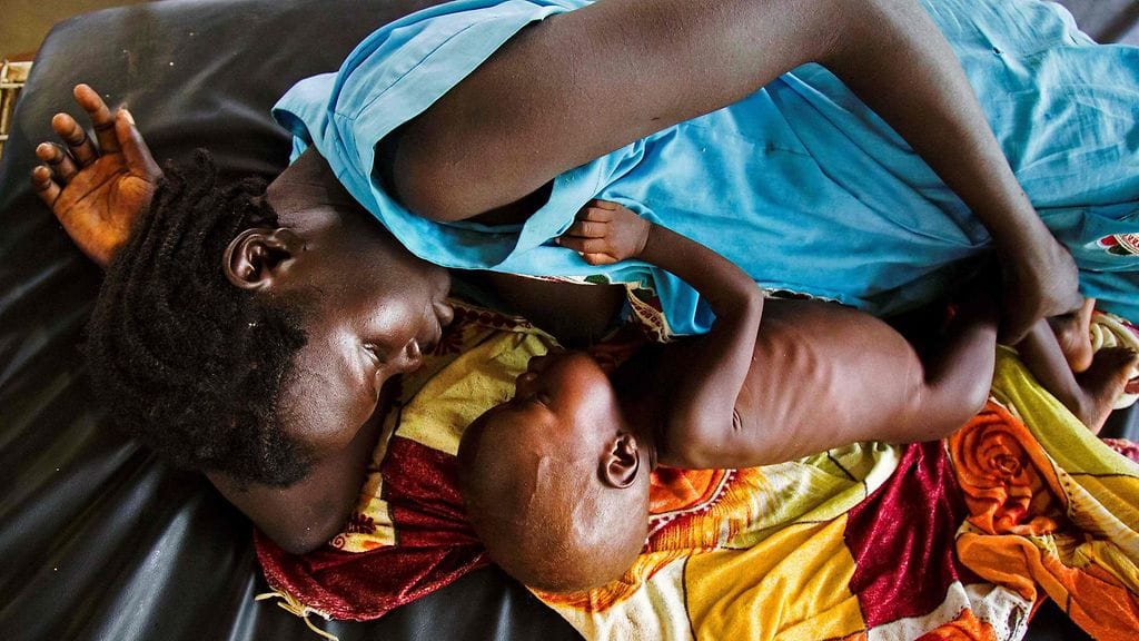 Lääkärit ilman rajoja -järjestön vastaanotolle tullut äiti rintaruokki aliravitsemuksista kärsivää lastaan 11. lokakuuta 2016.