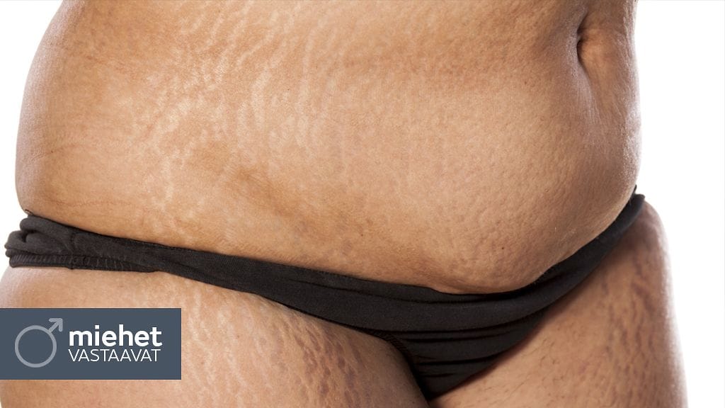 Juttusarjassa miehet vastaavat joka viikko kysymyksiin seksiin, ihmissuhteisiin ja muuhun elämään liittyen!