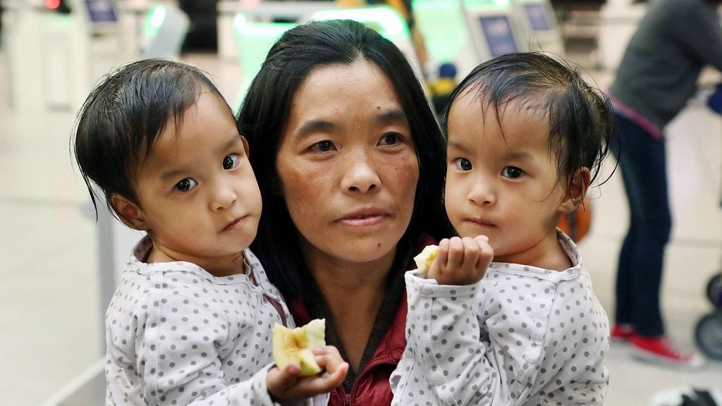 Nima ja Dawa irrotettiin toisistaan onnistuneesti leikkauksessa.