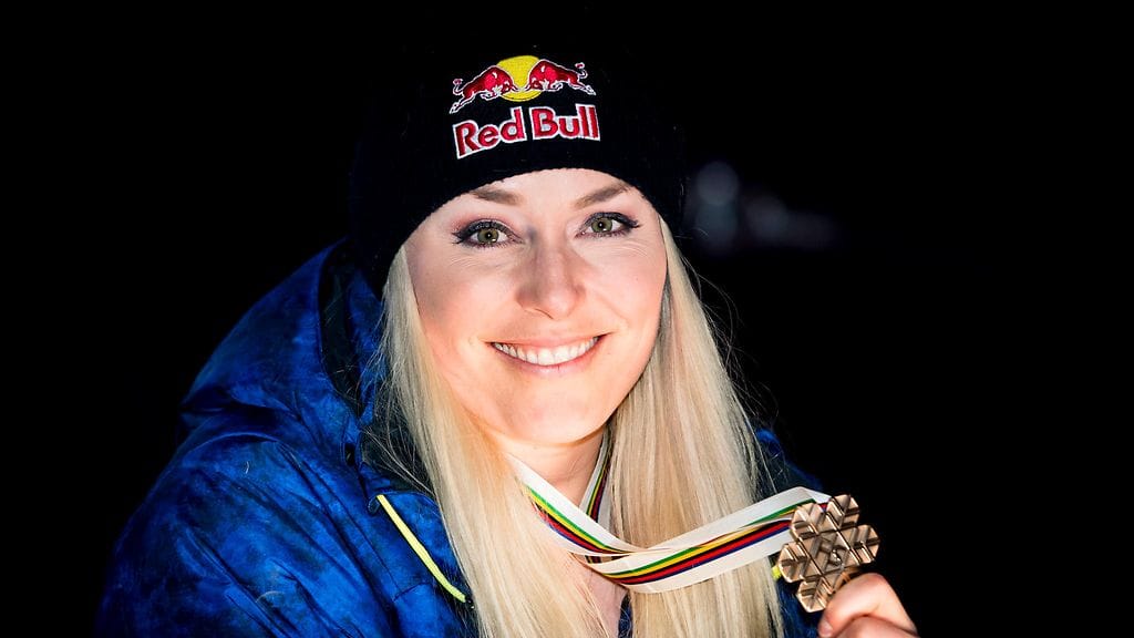 Jo uransa päättänyt alppihiihtolegenda Lindsey Vonn lähetti kuvaa leikkauspöydältään.