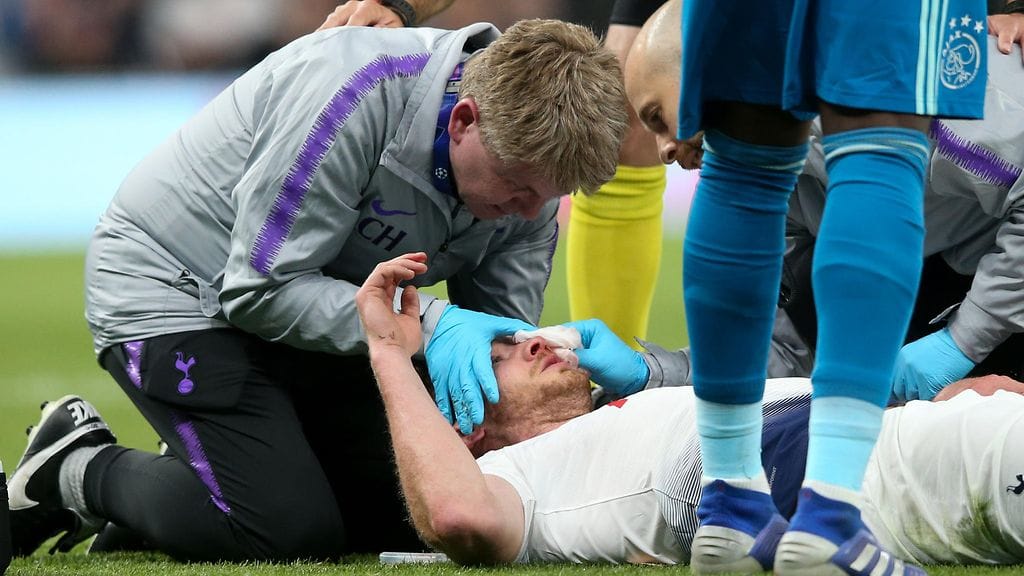 Tottenham-puolustaja Jan Vertonghen loukkaantui pääpallossa vakavan oloisesti.