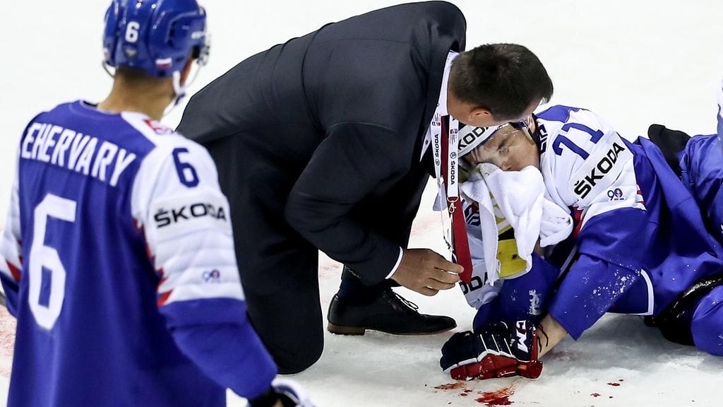 Slovakian puolustaja Marek Daloga loukkaantui Leijonia vastaan.