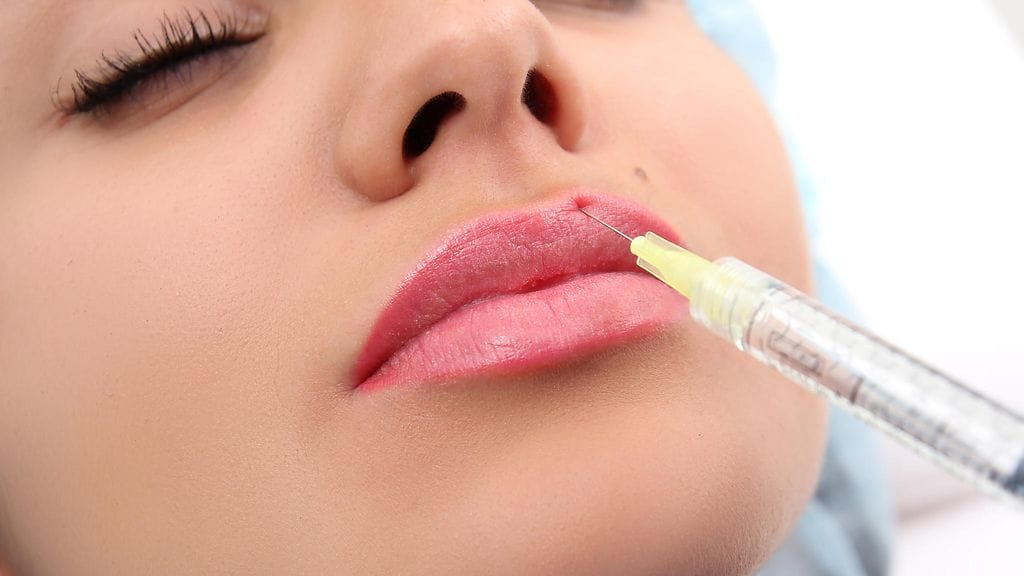 Täyteaineessa käytetty hyaluronihappo aiheutti allergisen reaktion.