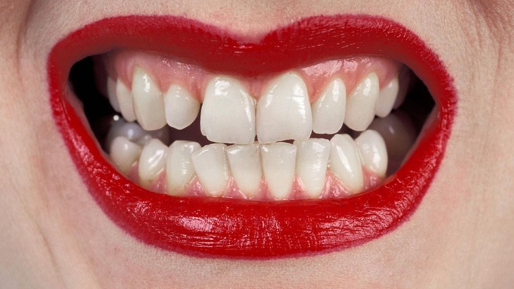 Järjestyksenvalvojaa puraissutta epäillään pahoinpitelystä.