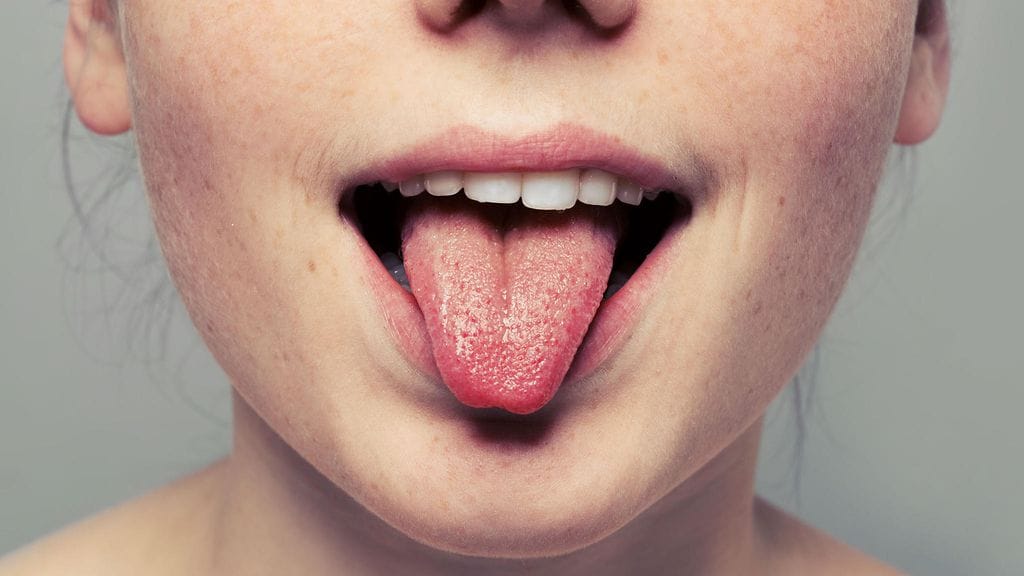 Iho on ihmisen suurin elin, ja sen pintakerroksen solukko elää yleensä 4-6 viikkoa. Sen jälkeen kuolleet solut kuluvat pois.