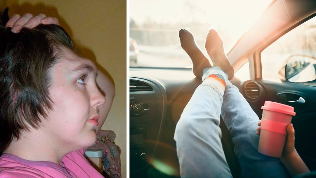 Irlantilainen Gráinne Kealy loukkaantui vakavasti vuonna 2006, kun hän joutui auto-onnettomuuteen. Lauennut turvatyyny paiskasi Kealyn kojelaudalle nostamat jalat päin hänen kasvojaan.