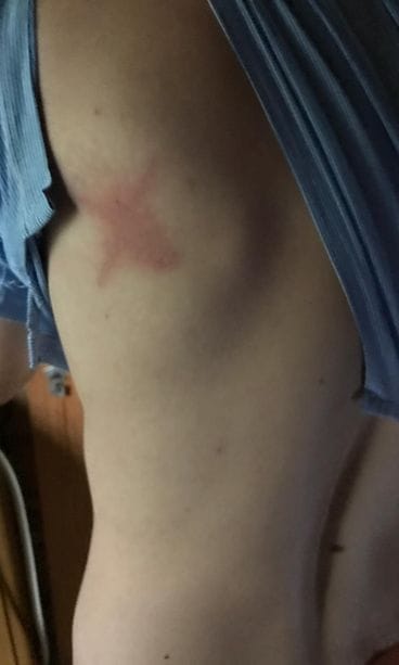 Salama iski golfpeelaja Benjaminia 1