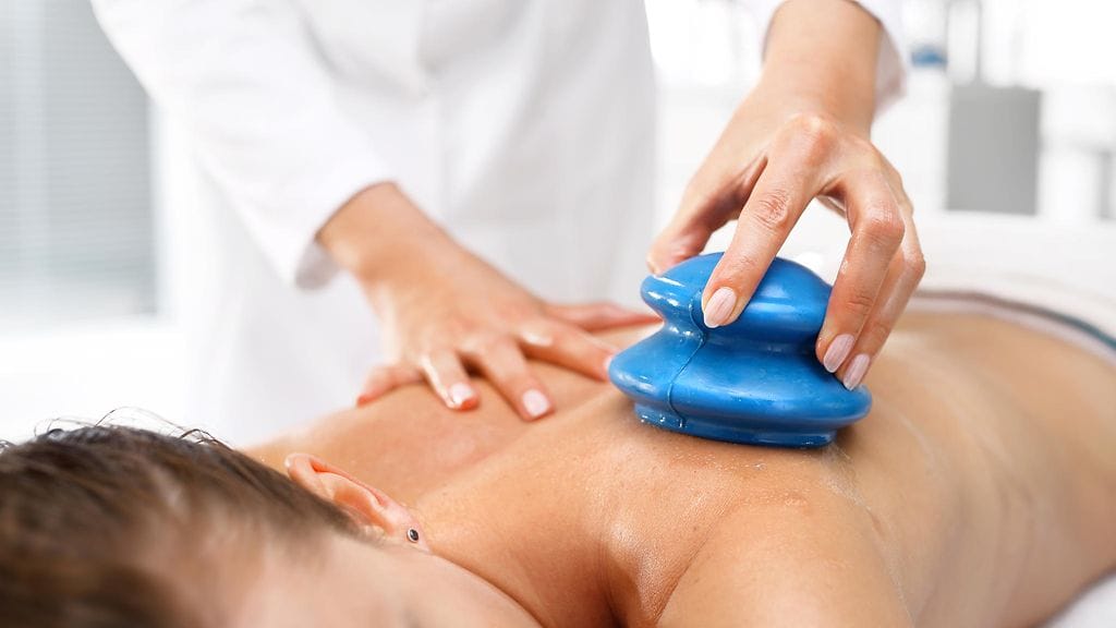 Kuivakuppaus voi olla hyvä vaihtoehto hieronnalle.