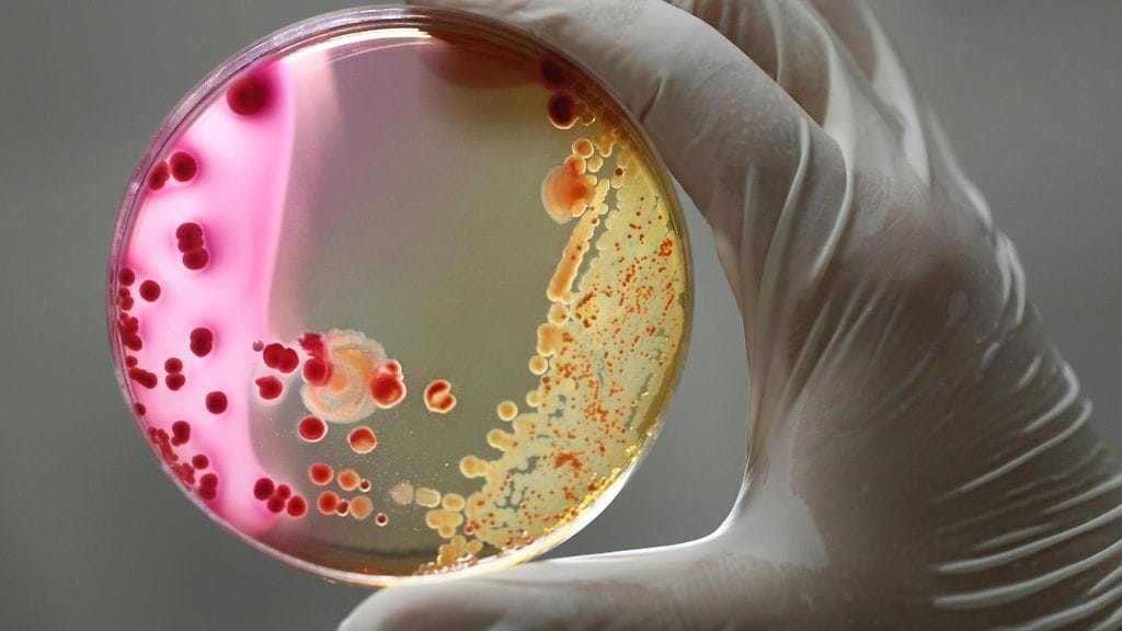 Bakteerit osaavat olla erittäin ovelia, jopa tappavan ovelia, taistelussaan antibiootteja vastaan.