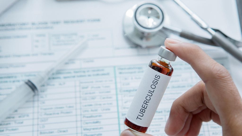 13 ihmistä on altistunut tuberkuloosille  Raumalla, kertoo Satakunnan hyvinvointialue.