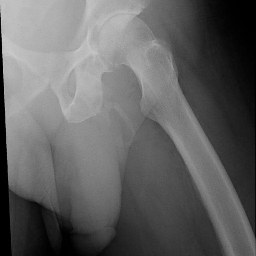 peniskuva 2 urology case reports