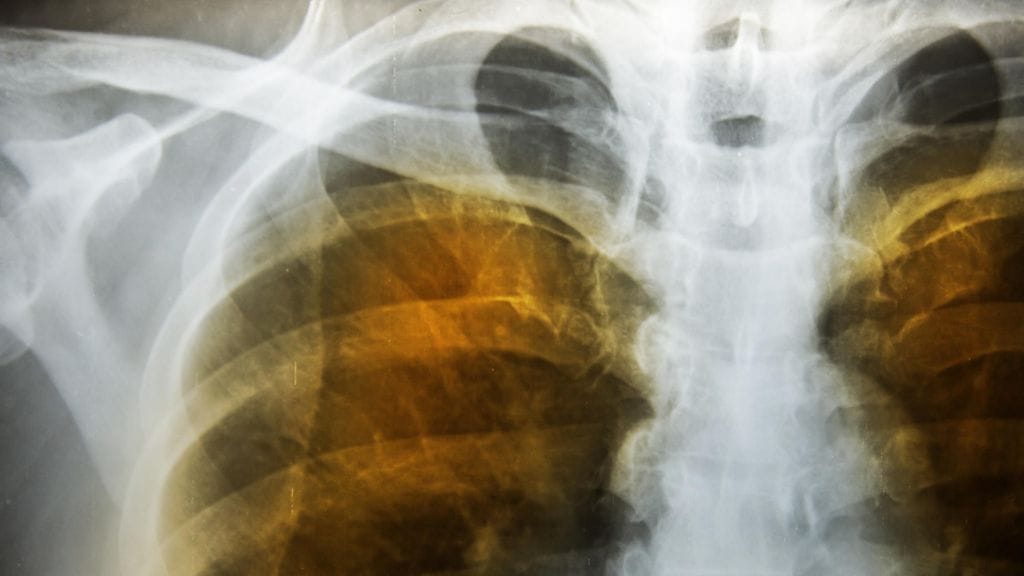 shutterstock_647074594