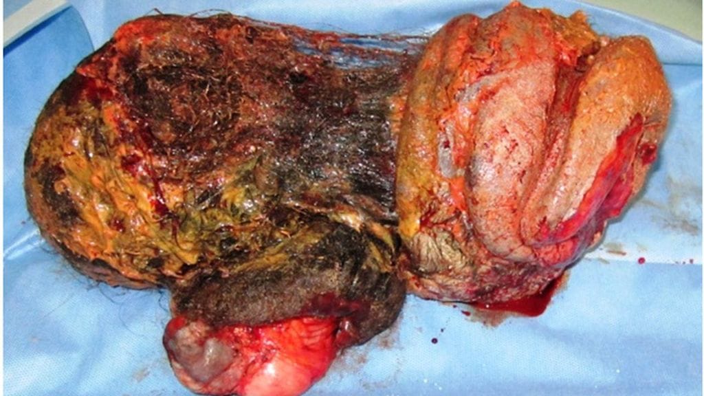 bmjcr-2019-August-12-8--F4.large