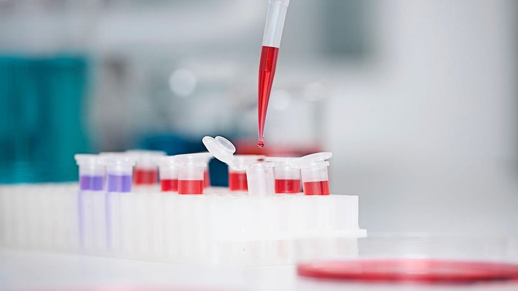 Monet aiemmin autismiin liitetyt geenit ilmentyvät poikkeavasti väkivaltaisilla psykopaateilla, selviää tuoreesta suomalaistutkimuksesta. Kuvituskuva.