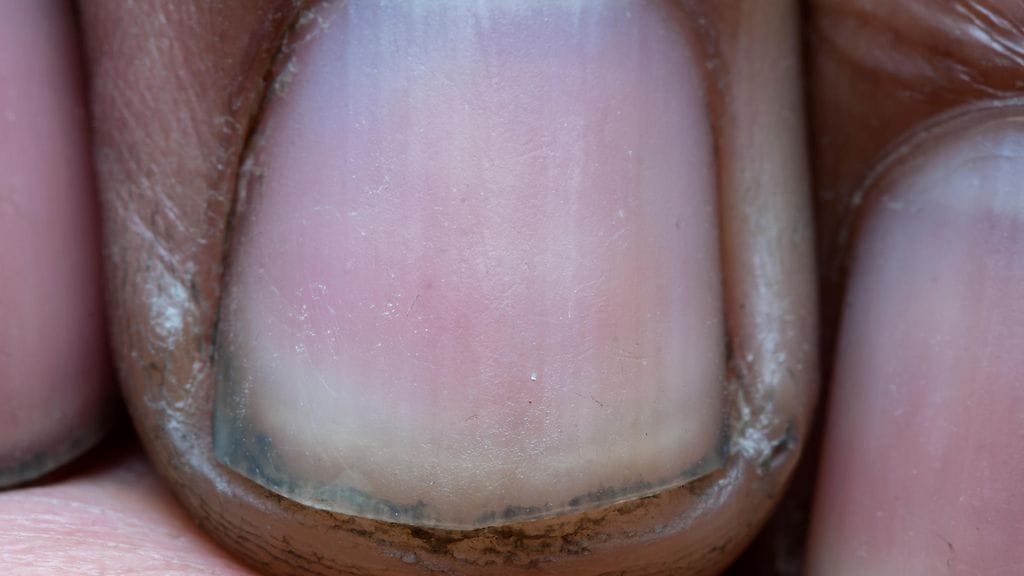 Sulhasen likaiset kynnet herättivät ihmetystä sosiaalisessa mediassa. Kuvituskuva.