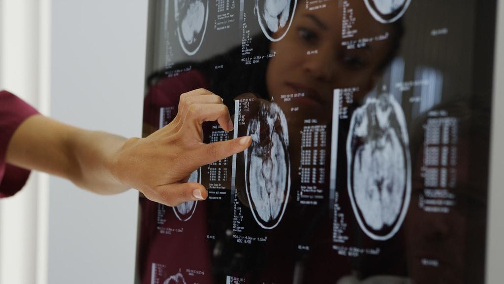 Anonyymiksi jääneestä miehestä kirjoitettiin tapausraportti British Medical Journal -julkaisuun. Kuvituskuva.