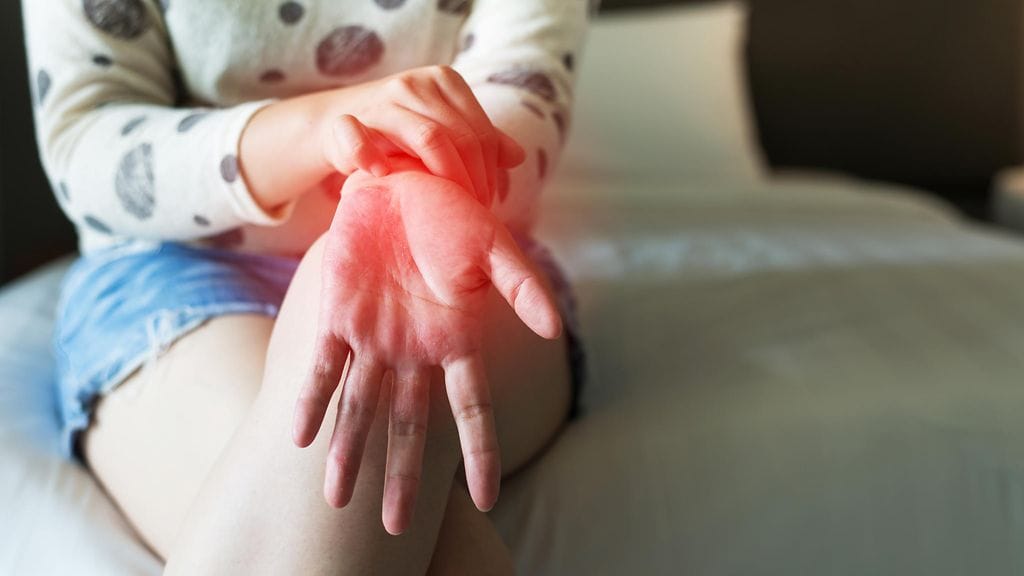 Naisen kädessä olleet läiskät olivat oireita keuhkosyövästä. Kuvituskuva.