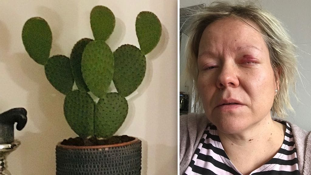 Kauhun hetket olohuoneessa: Suomalaisten suosima huonekasvi"ampui"kymmeniä piikkejä Sarin silmiin –"Tuntui kuin lasimurskaa olisi hierottu silmiä vasten"