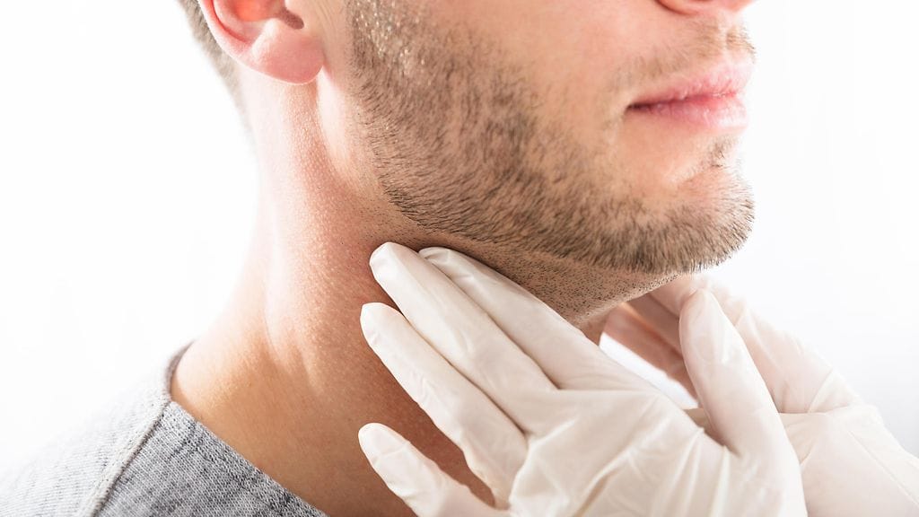 Lievempi kilpirauhasen vajaatoiminta tunnistetaan nykyään entistä paremmin.