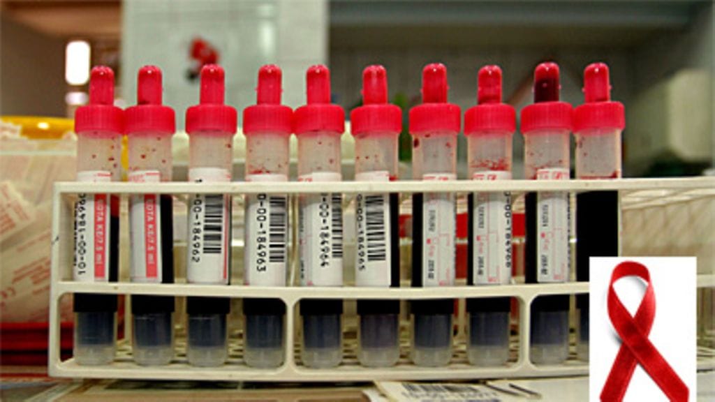 HI-viruksen leviäminen on vakavasti otettava nuorten venäläisten kuolinsyy. Asiantuntija ennustaa, että nykyvauhdilla tartuntojen määrä kaksinkertaistuu 4-5 vuodessa.