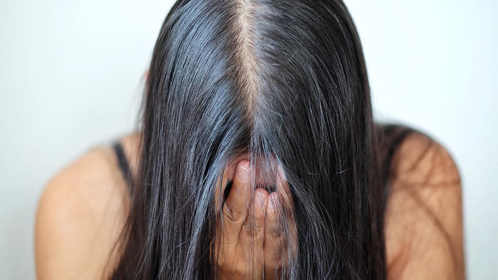 Stressi aiheuttaa harmaita hiuksia. Kuvituskuva.
