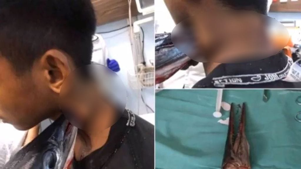Vedestä hypännyt nokkakala lävisti pojan kaulan Indonesiassa. Kuva: Youtube.