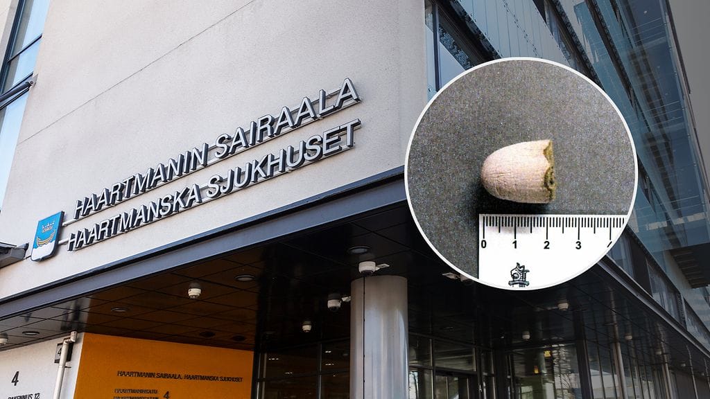 Miehen vatsasta löydettiin alle viiden gramman painoinen heroiinierä, jonka mies kertoi hankkineensa omaan käyttöönsä.