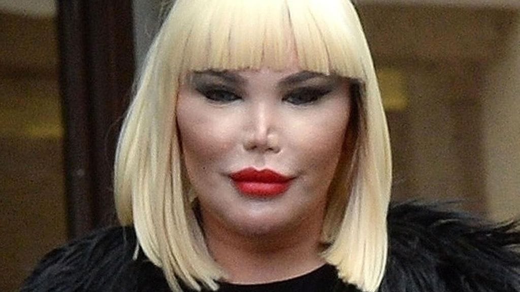 Tältä ihmis-Keninä tunnettu Roddy Alves näyttää nyt.