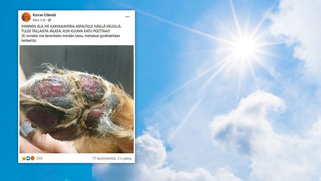 OMA: Aurinko, tassu, palovamma