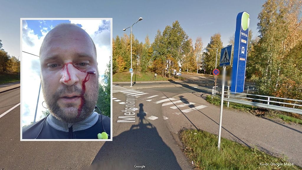 Auto töytäisi pyörällä liikkunutta Jussi Tapiota Vantaalla viime perjantaina.