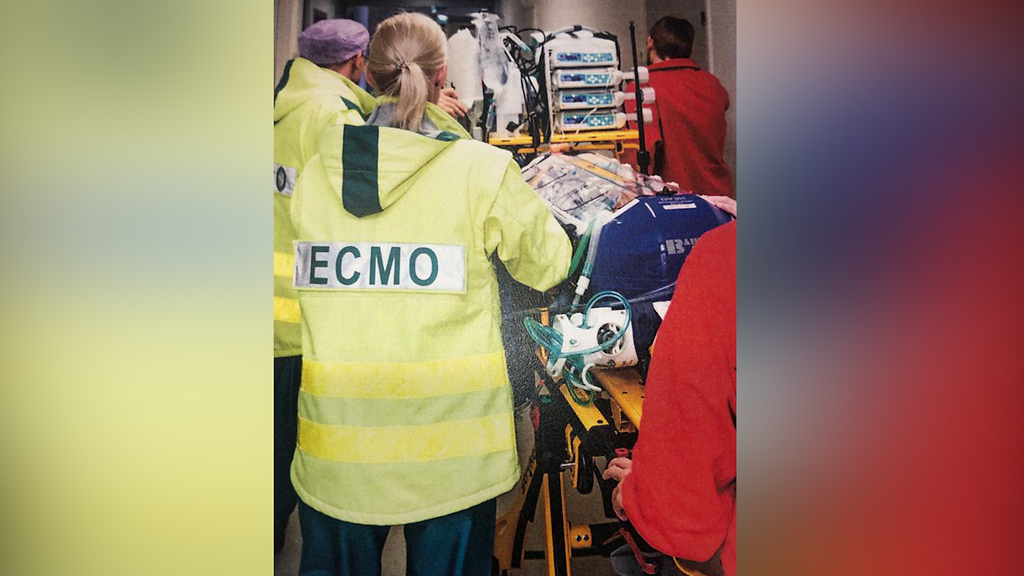 ecmo