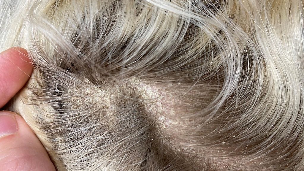 KUVA VAIN LIFESTYLEN ARTIKKELIIN