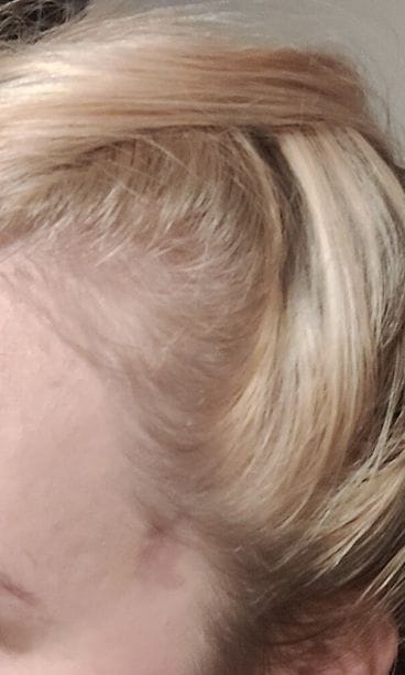 johanna hiustenlähtö