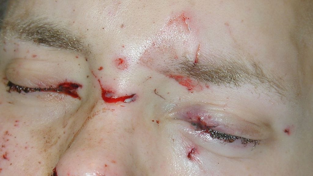 HUS rakettiruutiroiske