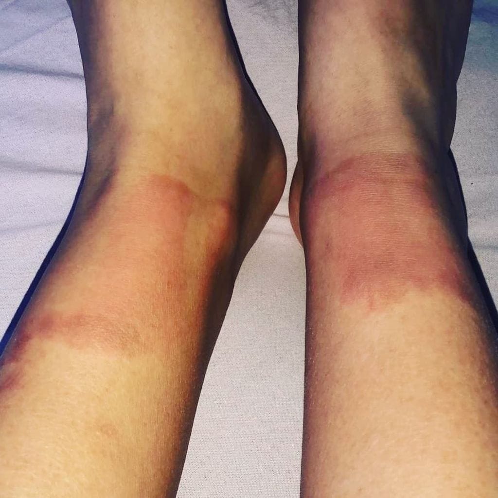 Lauran nilkat Eeva Toikkan kotialbumi