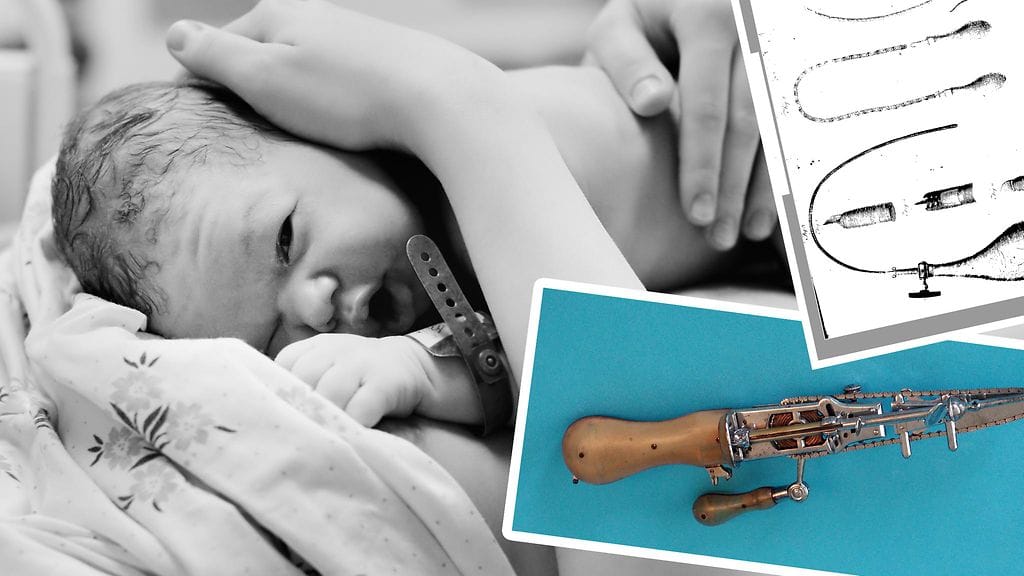 Moottorisaha kehitettiin alun perin avustamaan synnytyksessä. "Synnytyssaha" ei toki ollut nykyisen puunkaatovälineen kaltainen.