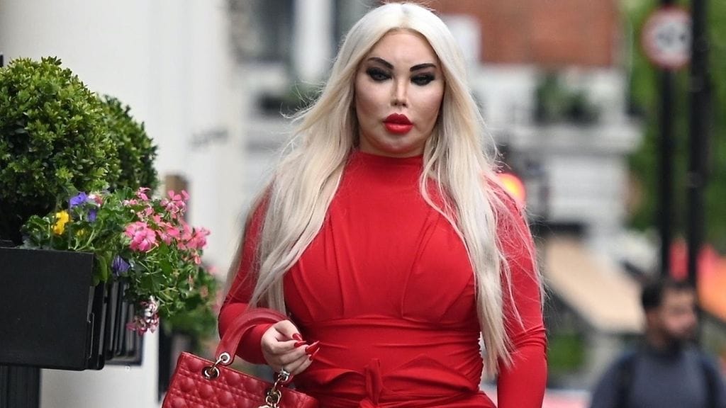 Ihmis-Keninä aiemmin tunnettu Jessica Alves kertoo korjanneensa sukupuoltaan.