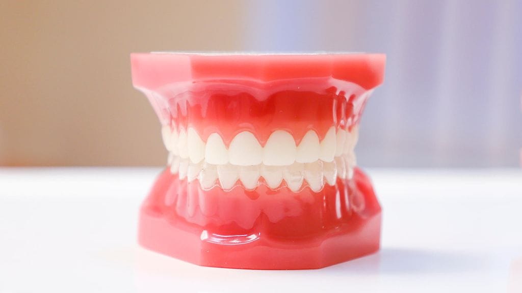 Tutkijoiden keksintö rajoittaisi suun avaamista. Kuvituskuva.