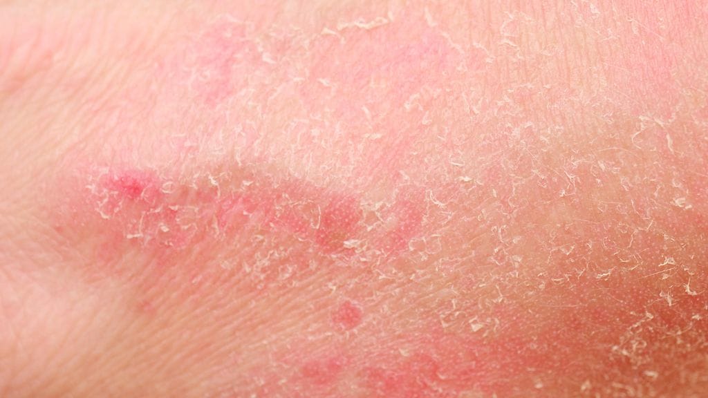 shutterstock_118328650