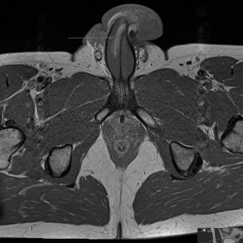 bmjcr-2021-June-14-6--F1.large