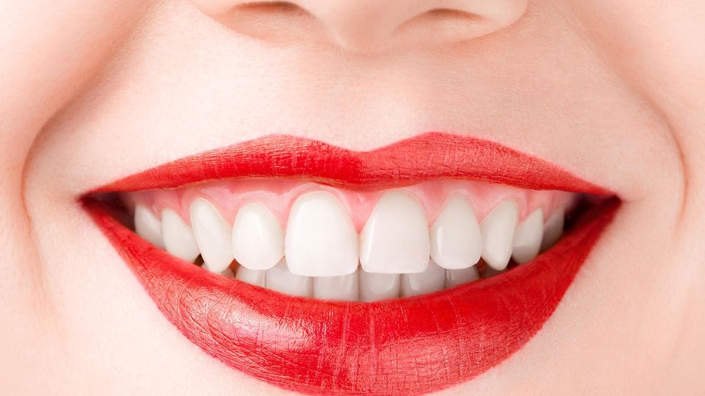 Naisen suu täytti ennätyskriteerit. Kuvituskuva.