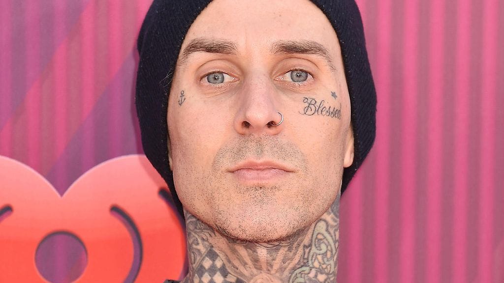 Travis Barker loukkasi helmikuussa sormensa soittaessaan rumpuja harjoituksissa.