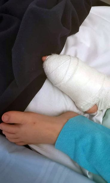 Pojan jalka leikkauksen jälkeen. Kuva Karri ja Riina
